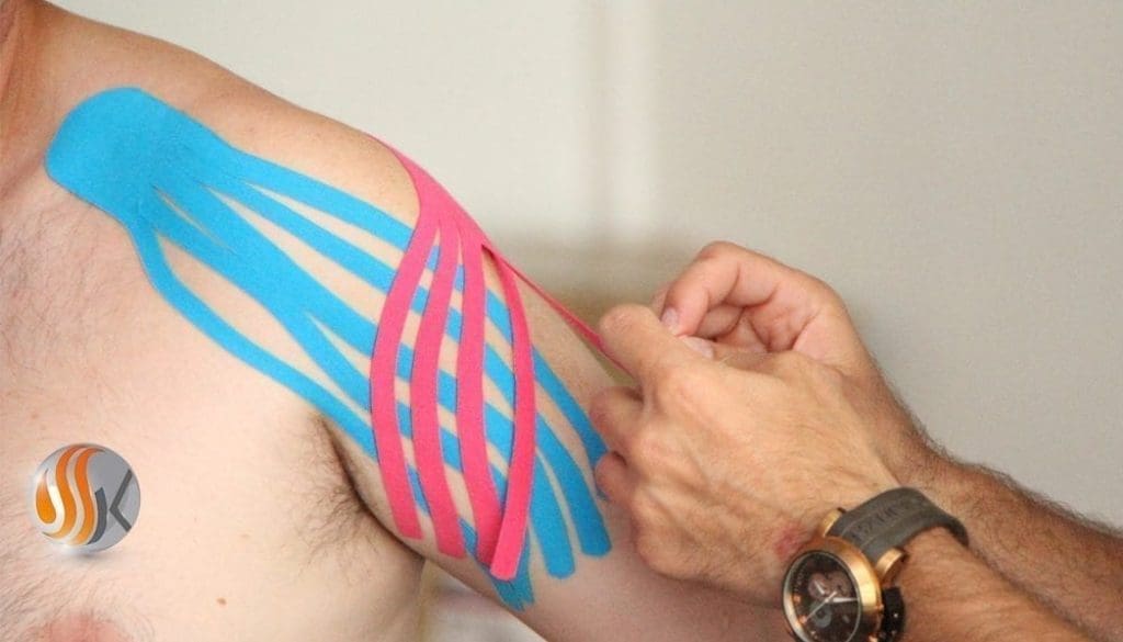 Taping neuromusculaire