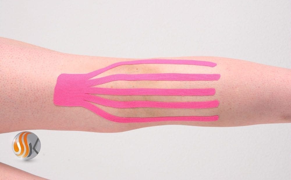 Taping neuromusculaire
