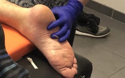 Dry needling kiné formation ssk