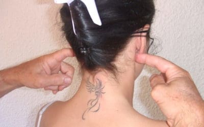 Reboutement Tissulaire Réflexe chez SSK - rf2