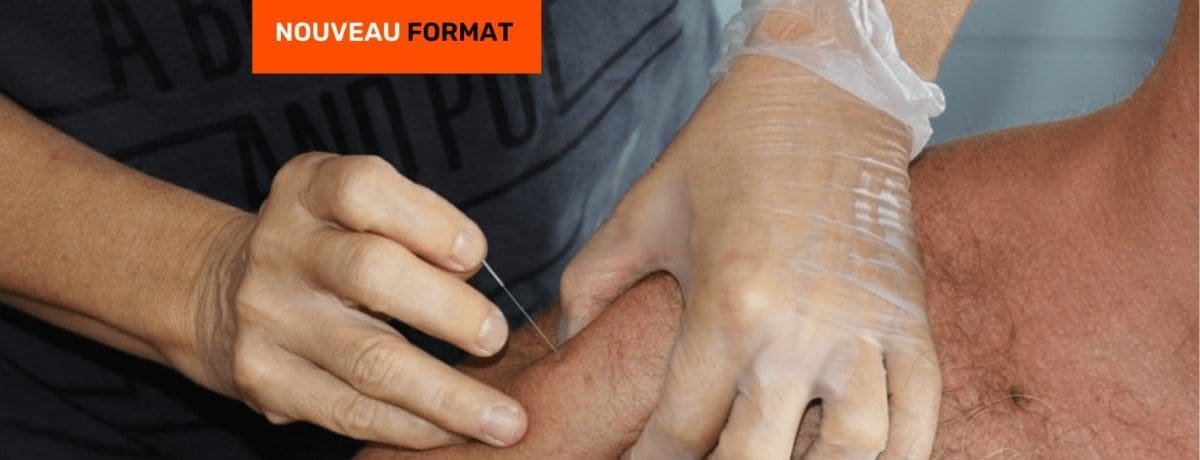 Dry Needling (18 Février – 23 Avril 2024) Lyon