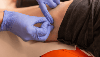 formaiton kiné dry needling