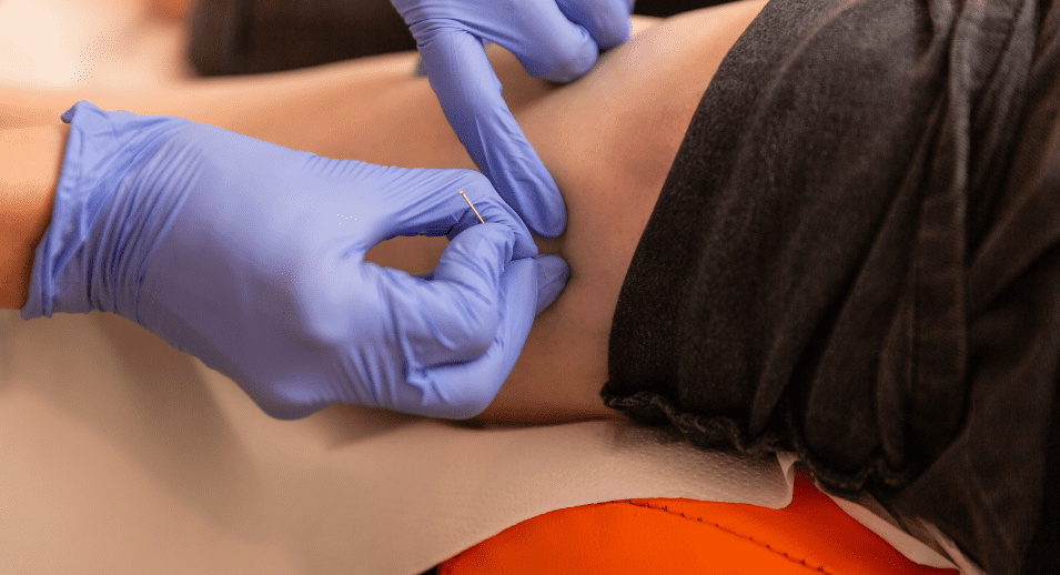 Dry Needling (8 Mai 2025 – 28 Septembre 2025) Toulouse