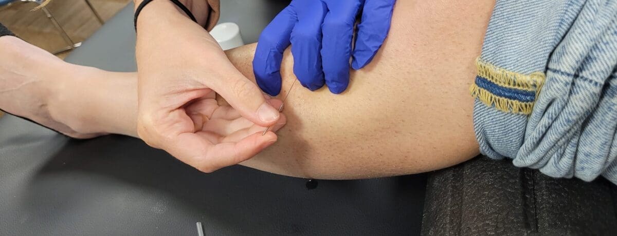 Dry Needling (19 Mars – 2 Juin 2026) Toulouse