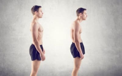 Man with impaired posture position defect scoliosis and ideal