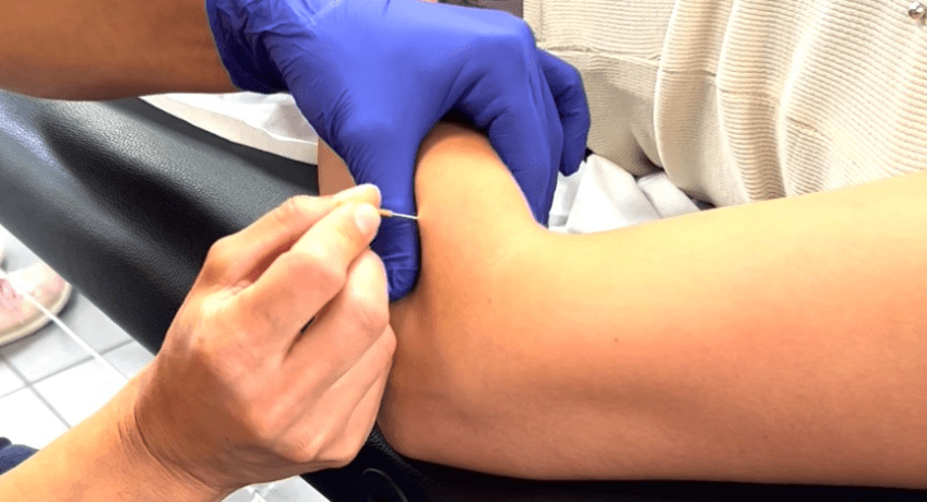 Dry Needling (28 Septembre – 15 Novembre 2025 ) Bouc Bel Air