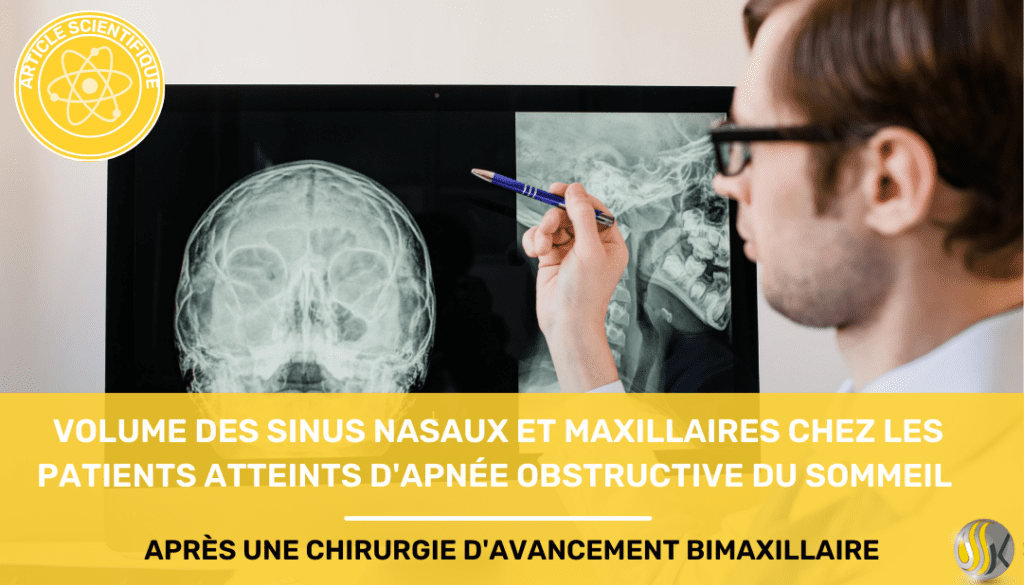 volume des sinus nasaux et maxillaires chez les patients souffrant d'apnée obstructive du sommail apres une chirurgie davancement bimaxillaire