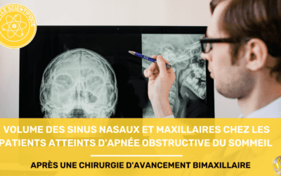 volume des sinus nasaux et maxillaires chez les patients souffrant d'apnée obstructive du sommail apres une chirurgie davancement bimaxillaire