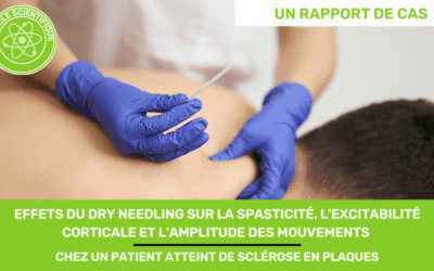 Effets du Dry Needling sur la spasticité, l'excitabilité corticale et l'amplitude des mouvements chez un patient atteint de sclérose en plaques un rapport de cas