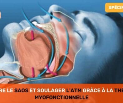 Réduire le SAOS et Soulager l'ATM grâce à la Thérapie Myofonctionnelle