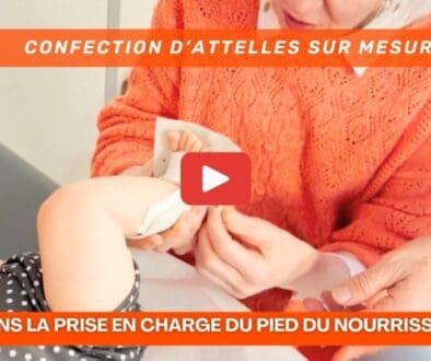 L’Art de l’Attelle sur Mesure dans la Prise en Charge du Pied du Nourrisson (vidéo)