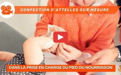 L’Art de l’Attelle sur Mesure dans la Prise en Charge du Pied du Nourrisson (vidéo)